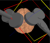 Multi_Coil