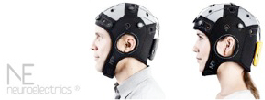 tdcs-illustration-1